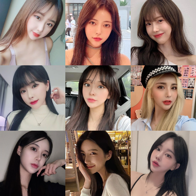 Nhiều phụ nữ có đường nét khuôn mặt đẹp sau khi lấp đầy thể tích bằng filler tạo hình.