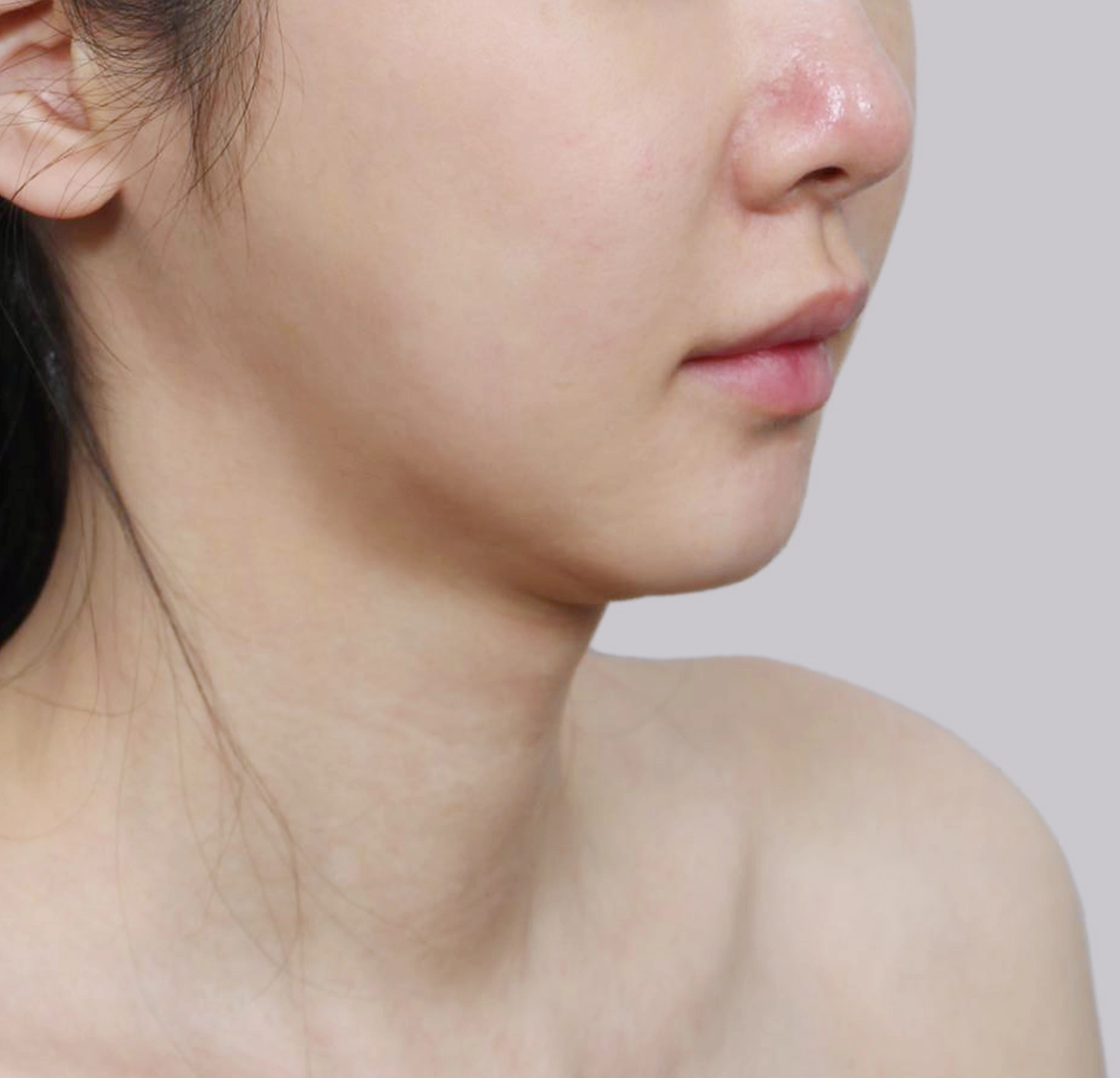 Căng Da Mặt Mini-45도-전