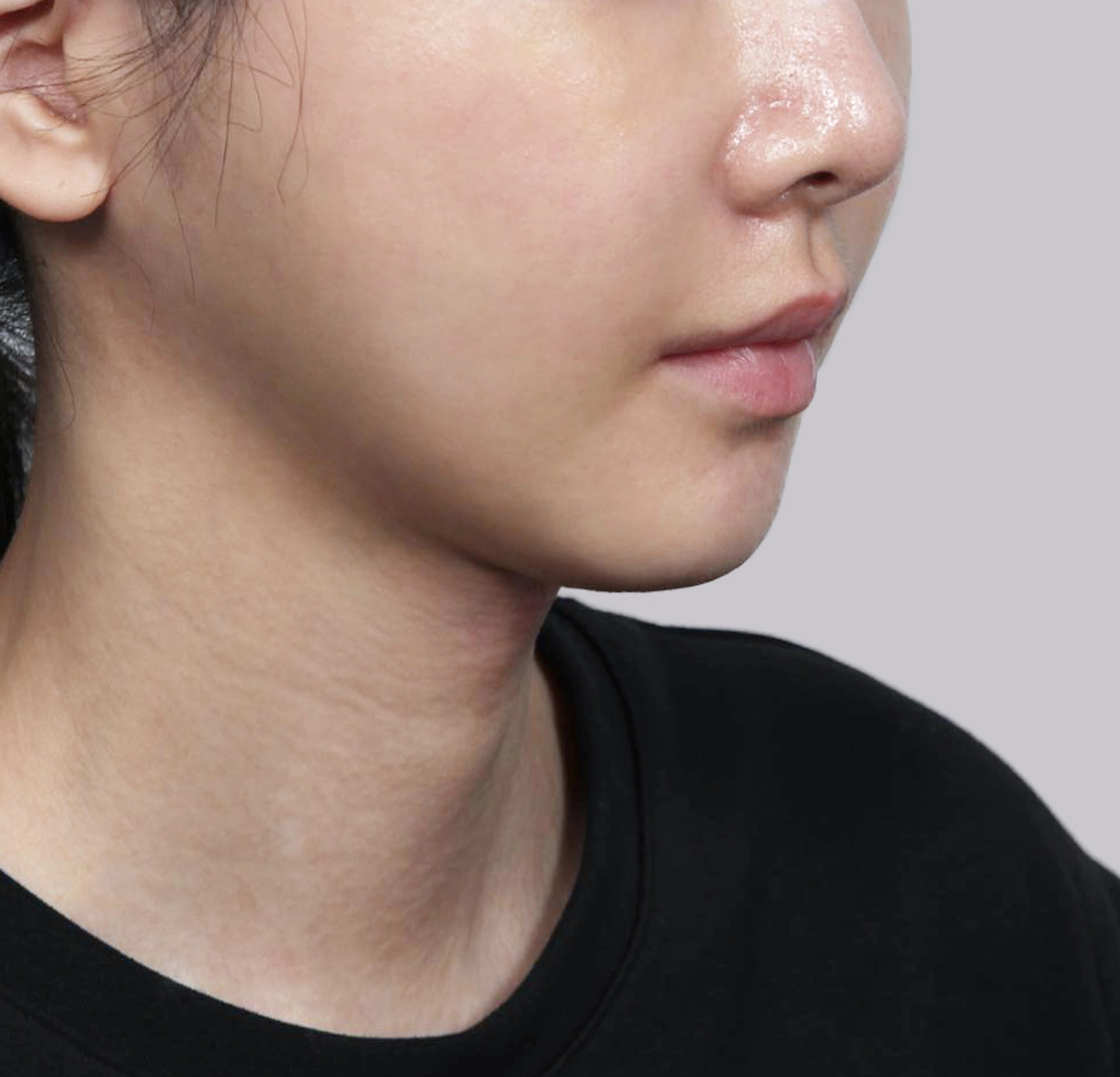 Căng Da Mặt Mini-45도-후